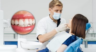 Чому не ростуть зуби мудрості та чи потрібно щодо цього хвилюватися