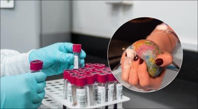 Группа крови Группа крови