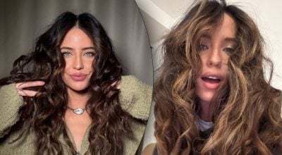 "Больно на это смотреть": Дорофеева напугала синяками на теле