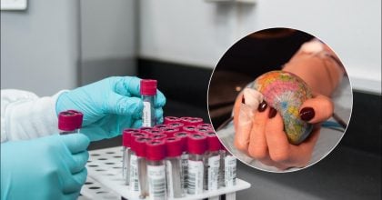 Лише 1 людина з 6 млн: яка група крові зустрічається найрідше і чим вона цінна