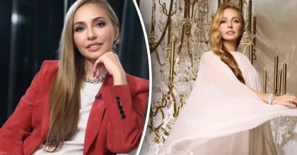 "Що в неї з обличчям": дружина путініста Пєскова зробила собі пластику