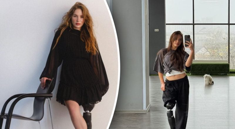 "На протезе еще не выступала": ветеран Руслана Данилкина идет на "Танцы со звездами"