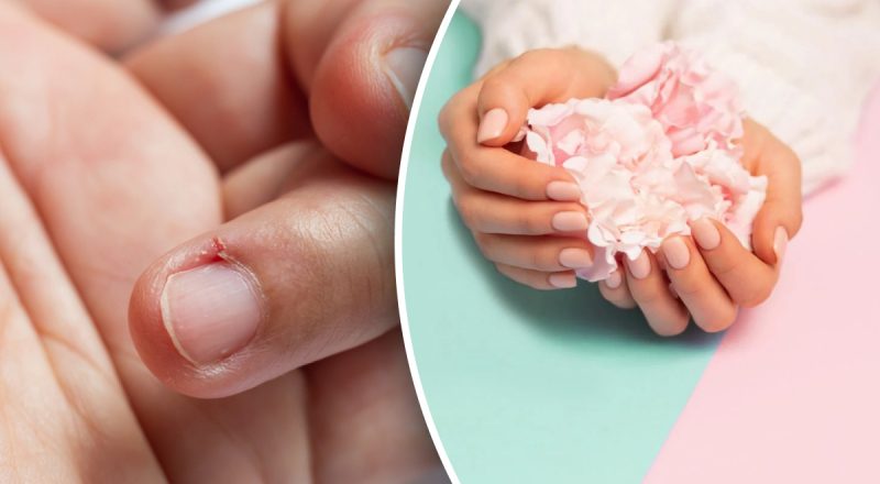 Чому з'являються задирки та як їх позбутися: поради професіонала