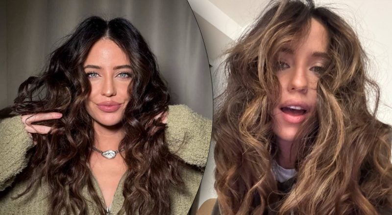 "Больно на это смотреть": Дорофеева напугала синяками на теле