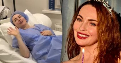 "Перша пластична": зірка "Дизель Шоу" показала обличчя після операції