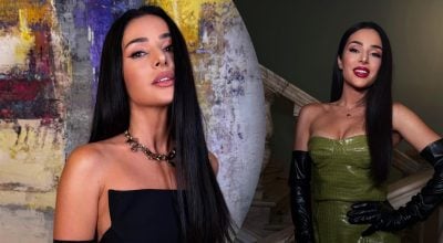 "Поделюсь опытом": Огневич заговорила о пластических операциях