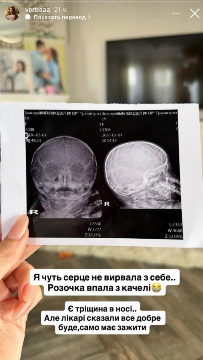 Травма дочери Юлии Вербы