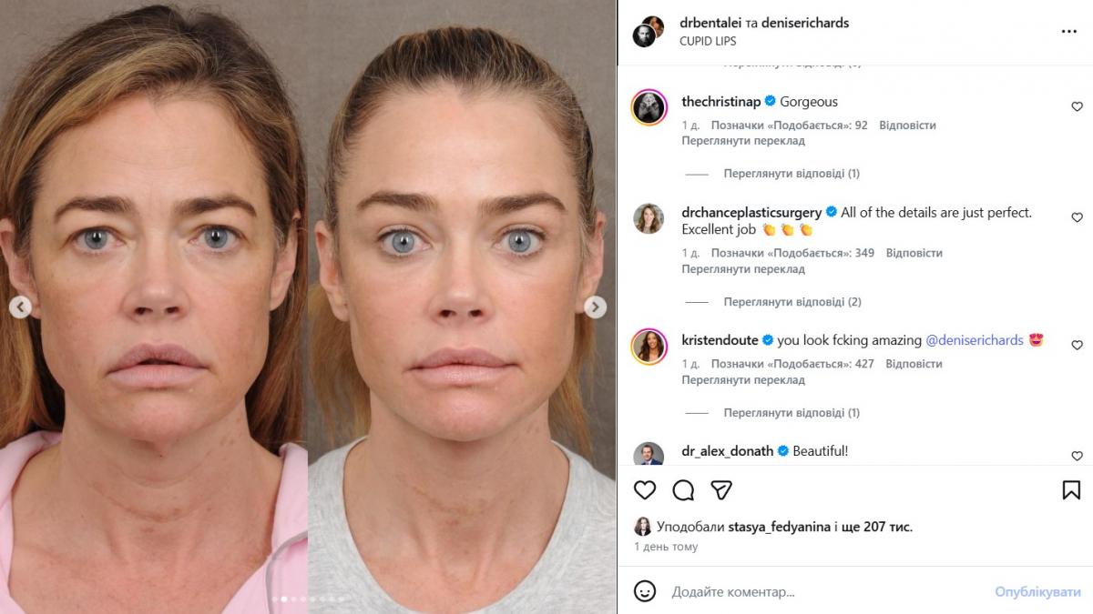 Дениз Ричардс