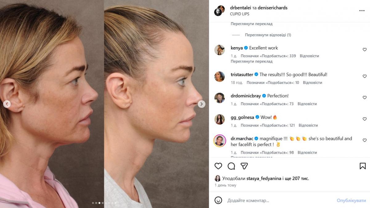 Дениз Ричардс