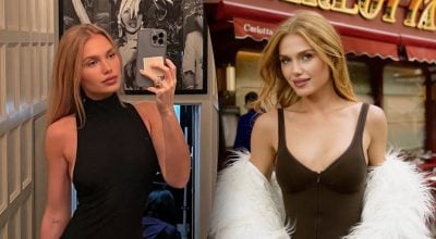 "Втрачу волосся і зуби": фіналістка "Холостяка" показала наслідки розладу