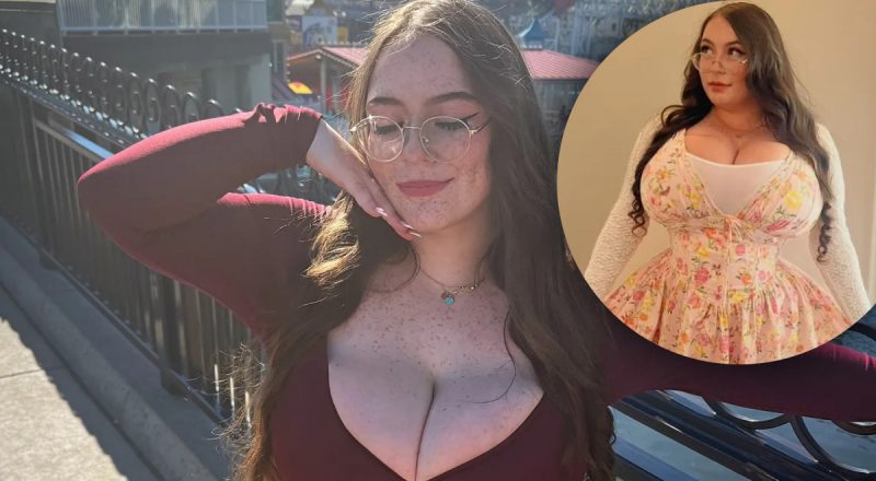 Груди продовжують рости: лікарі роками не розуміли, що відбувається з дівчиною