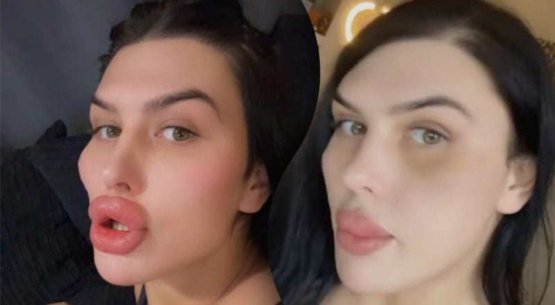 Как выглядят губы за 29 млн гривен: модель перестали узнавать родные