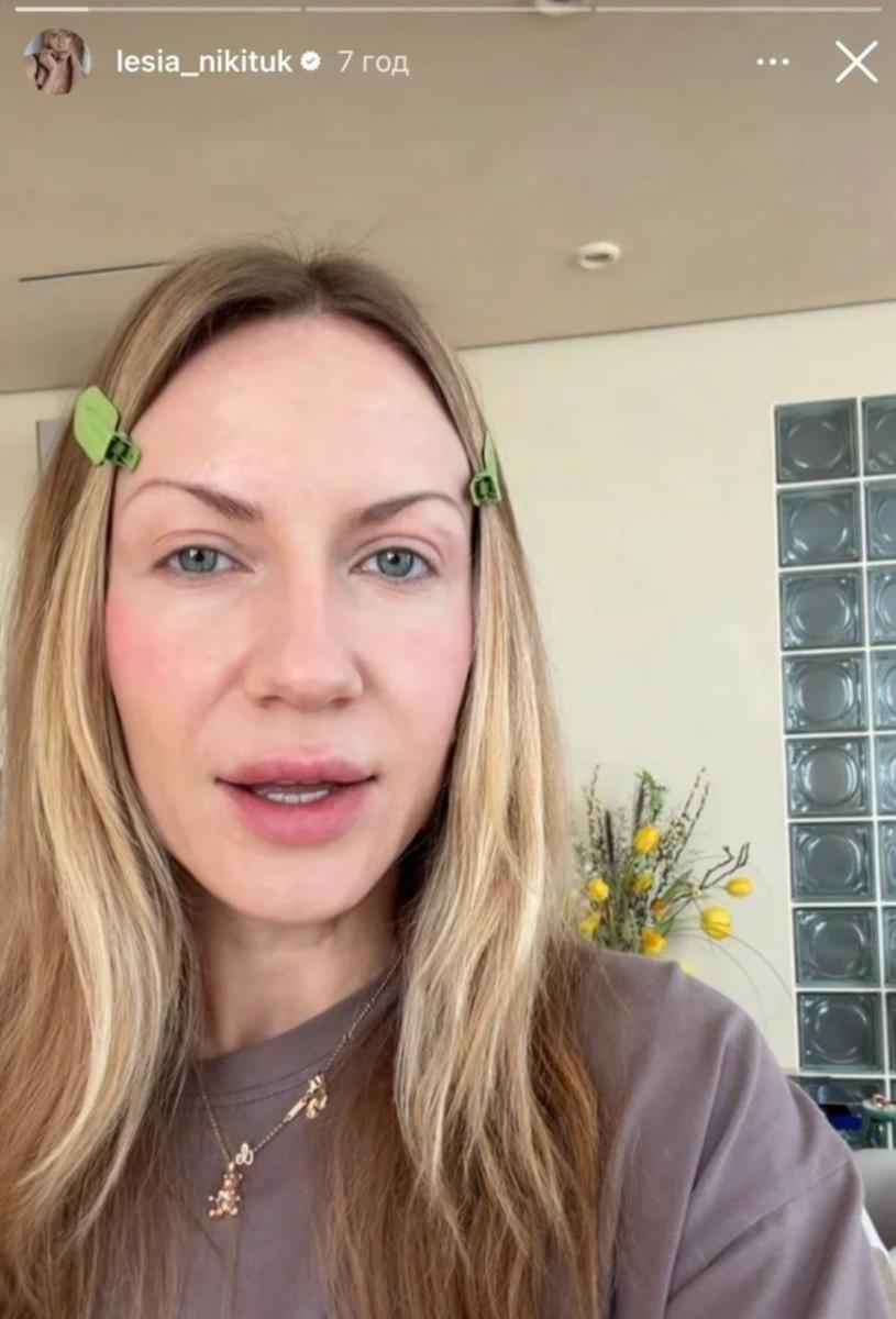 Над лівим оком Лесі Нікітюк з’явився синець