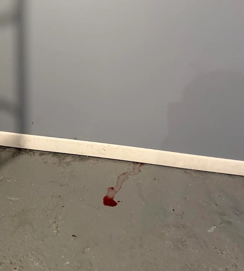 Жінка показала темні плями, схожі на засохлу кров