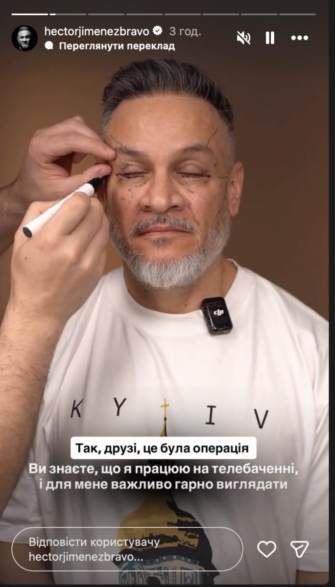 Ектор Хіменес Браво зважився на операцію Ектор Хіменес Браво зважився на операцію