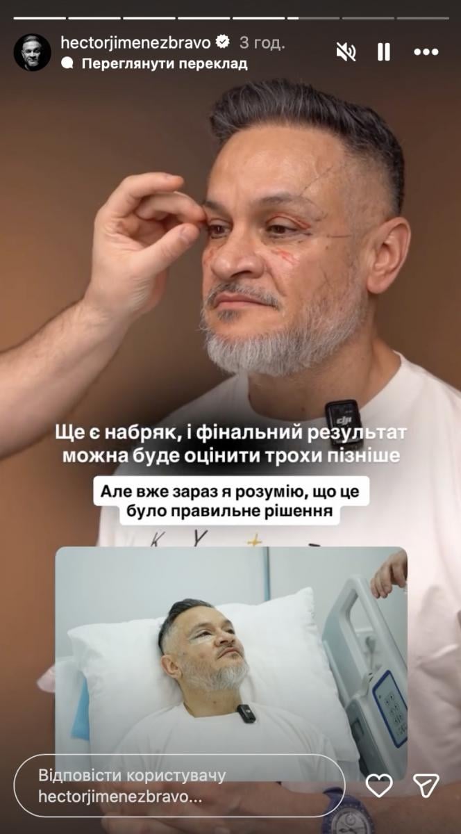 Ектор Хіменес Браво розповів про подробиці операції Ектор Хіменес Браво розповів про подробиці операції