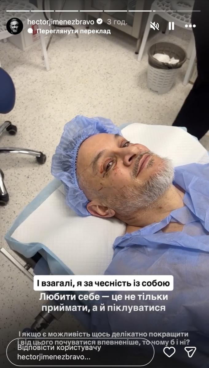 Ектор Хіменес Браво розповів про подробиці операції Ектор Хіменес Браво розповів про подробиці операції