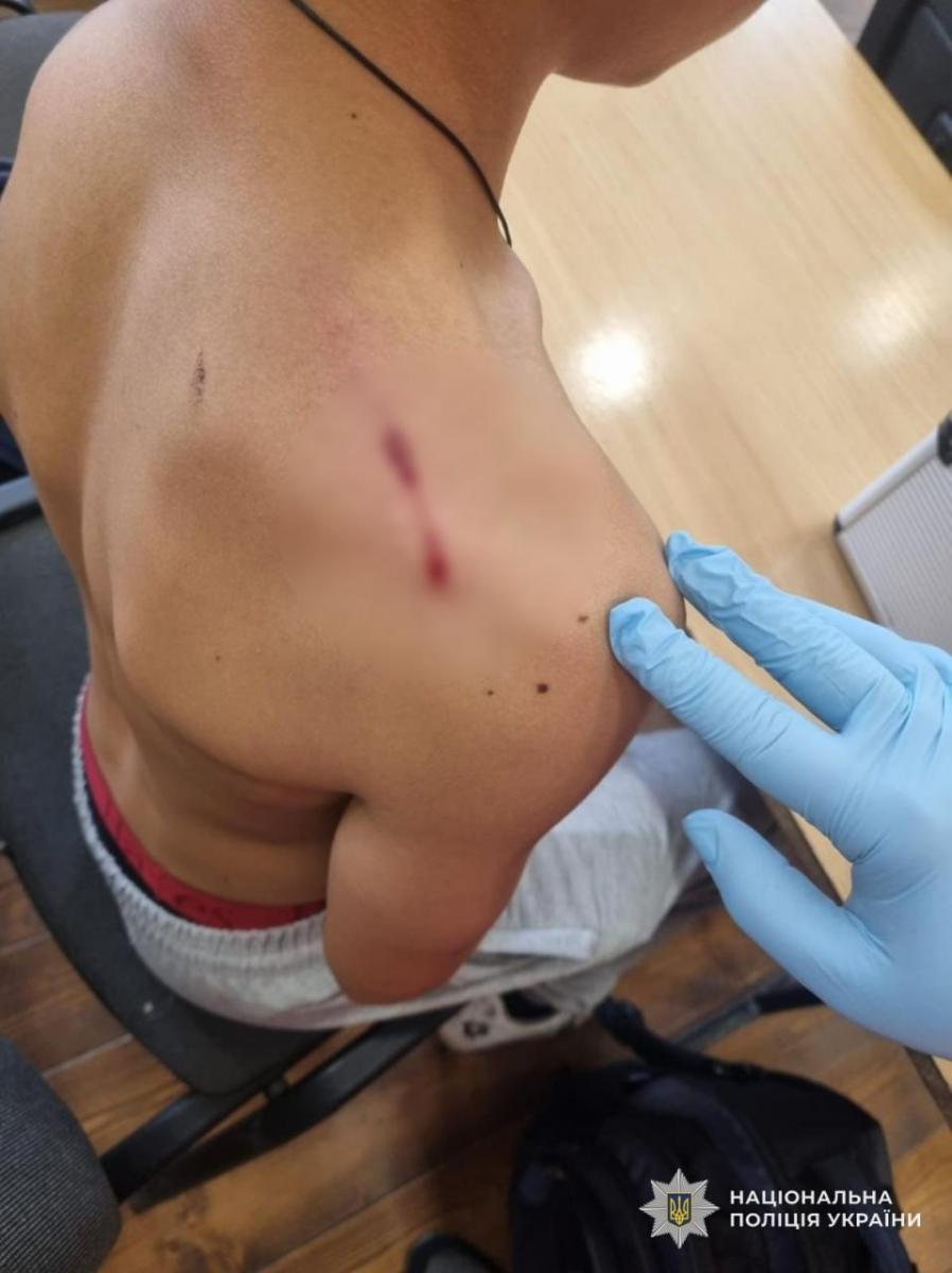 Стрілянина у школі на Закарпатті