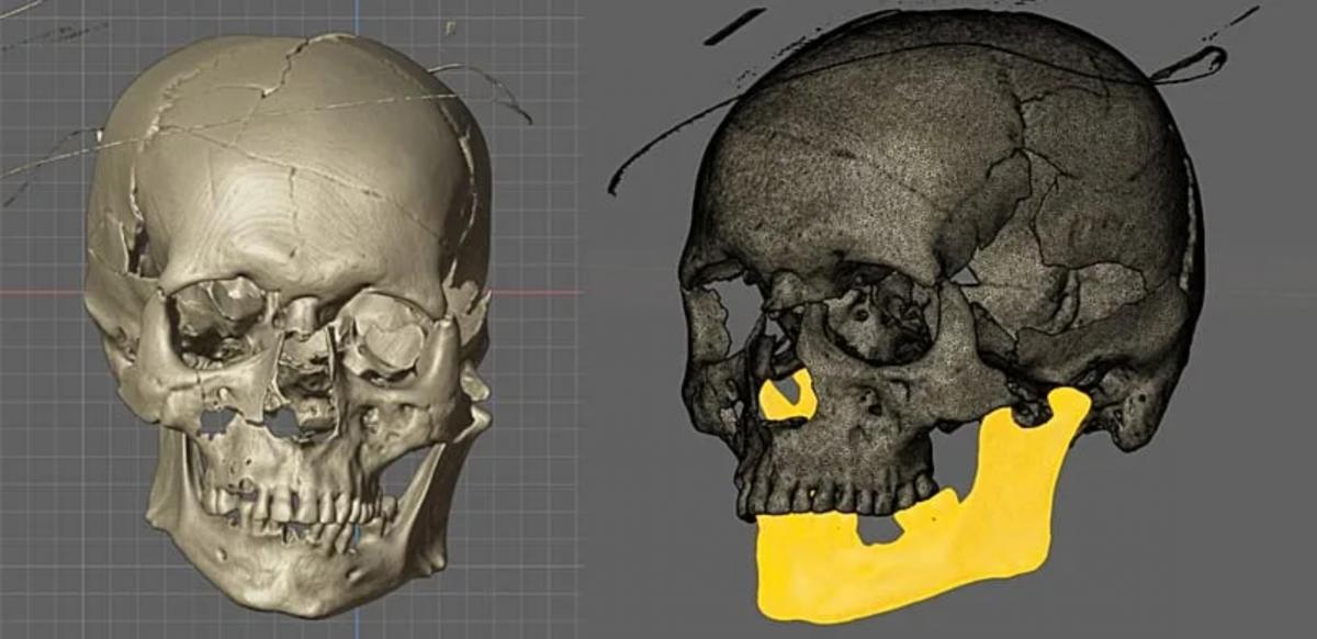 Череп ймовірного вампіра було знайдено в Хорватії у 2023 році