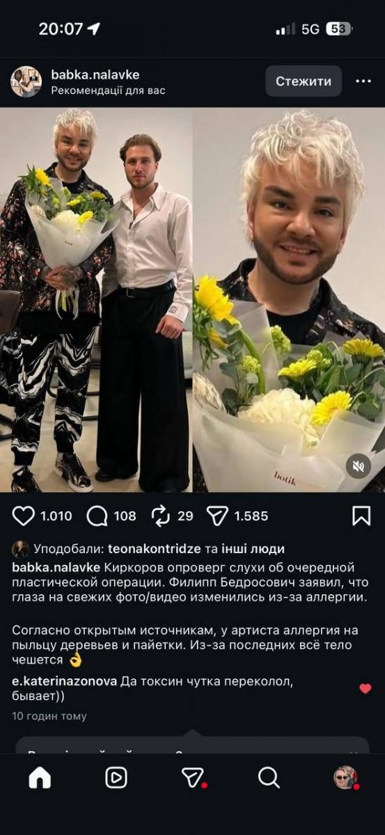 Кіркоров з'явився з новим обличчям