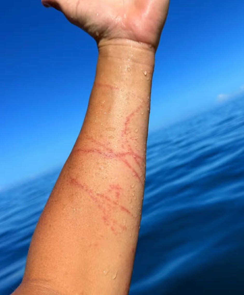 Турист раптово відчув різкий біль