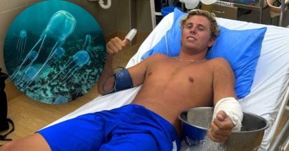 Туриста вкусила найотруйніша істота: протиотрута не допомогла