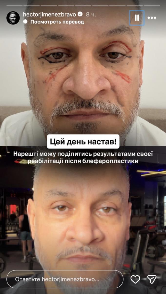 Эктор Хименес-Браво показал, как изменился после пластической операции