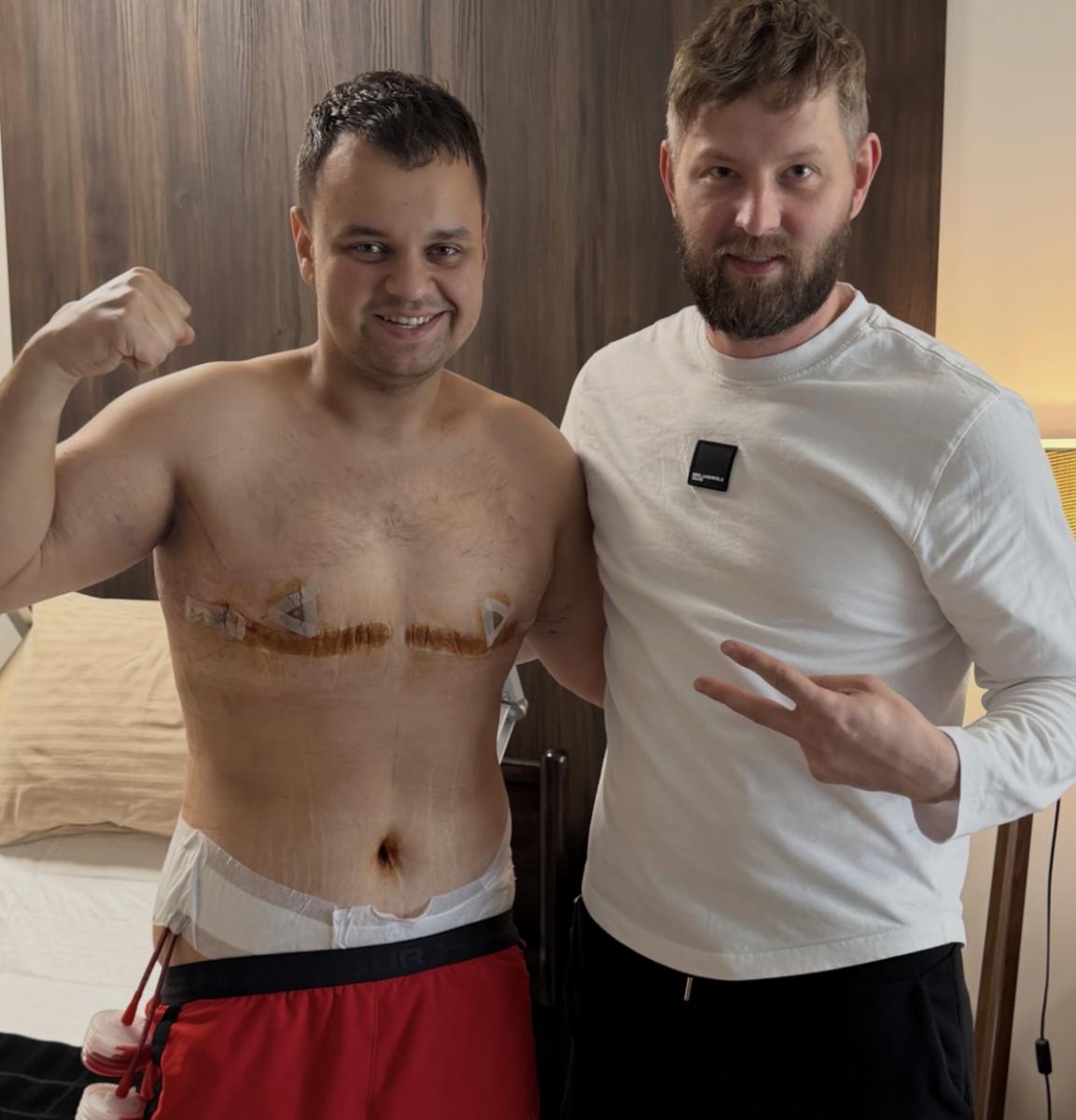 Вадим Бойко сильно похудел 