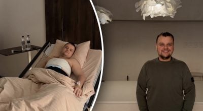 Вадим Боча показал результаты после пластики 