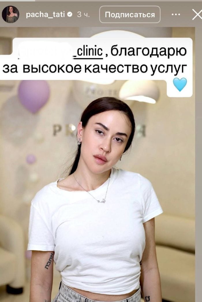 Дочка прихильниці Путіна стала невпізнанною Дочка прихильниці Путіна стала невпізнанною