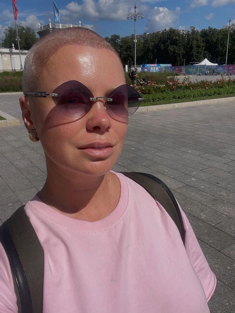 Звезда сериалов стала лысой Звезда сериалов стала лысой