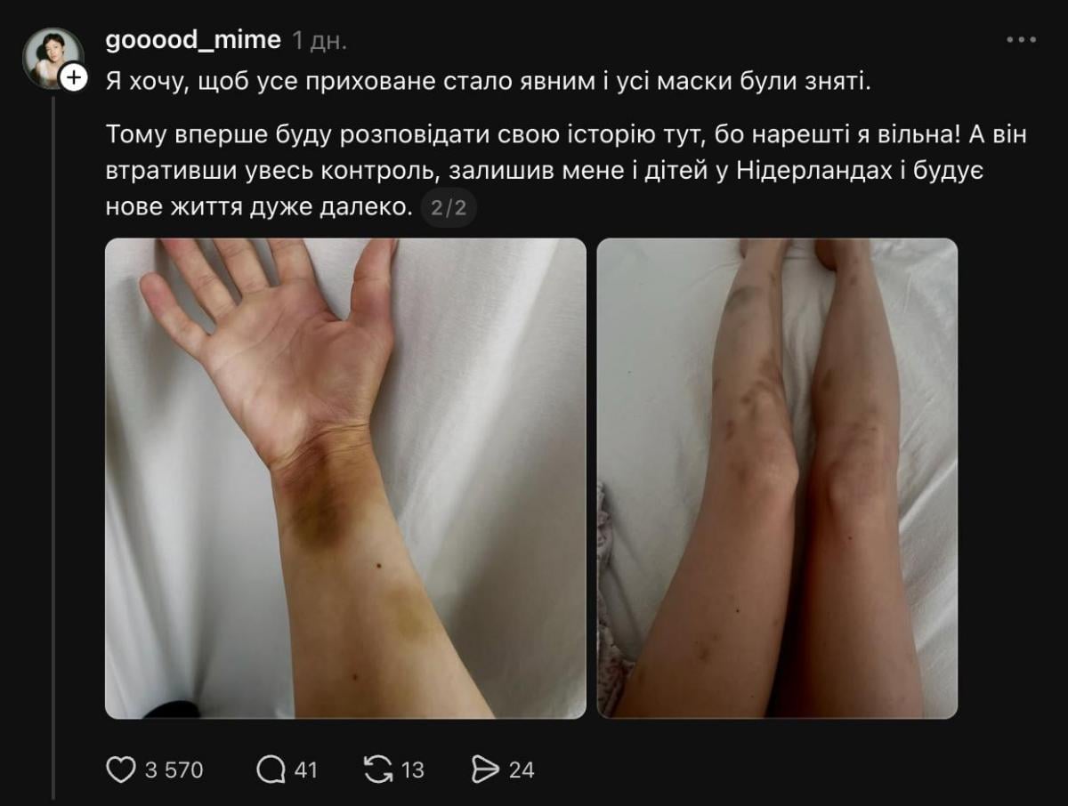 Жена Вячеслава Гармаша показала побои