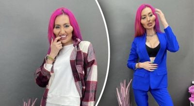 Українка з найбільшими вилицями вирішила їх видалити Українка з найбільшими вилицями вирішила їх видалити