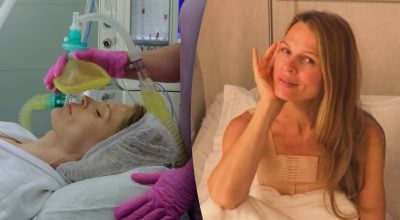 "Операція затягнулася через ускладнення": Фреймут наважилася на складну пластику