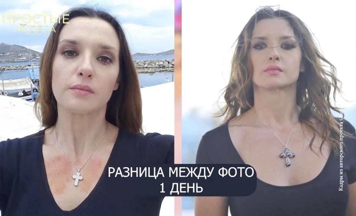 Оксана Марченко - наслідки хвороби Оксана Марченко - наслідки хвороби