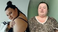 Мне больно: Alyona Alyona показала живот после уменьшения желудка