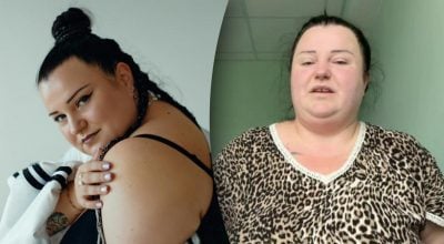 "Мені боляче": Alyona Alyona показала живіт після зменшення шлунка